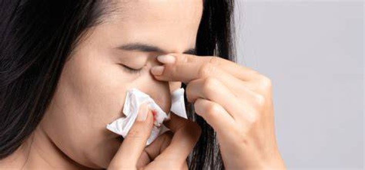 Bleeding Nose: An Unusual Anxiety Symptom