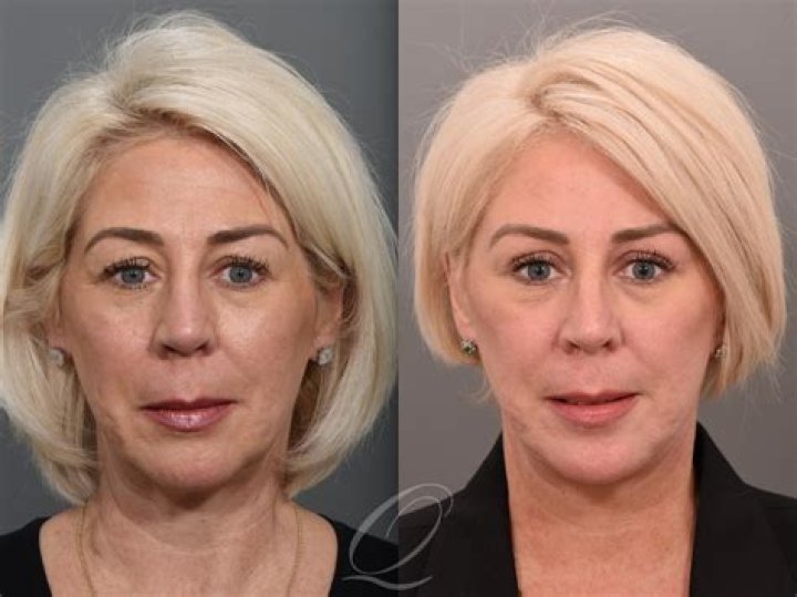 The GOOD plastic surgery thread